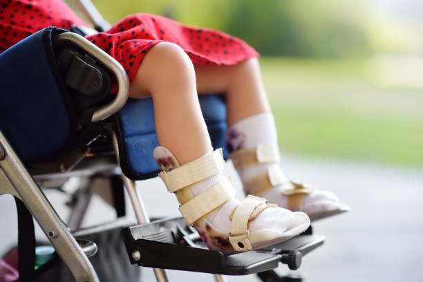 Latest Treatment Options for Cerebral Palsy