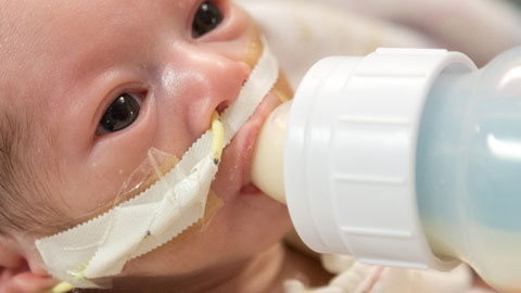 preemie feeding formalu milk