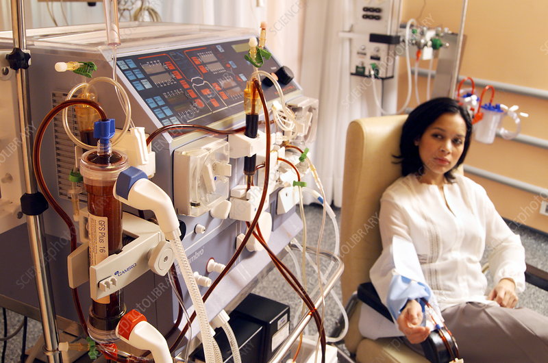 young woman with polycystic kidney disease on kidney dialysis treatment