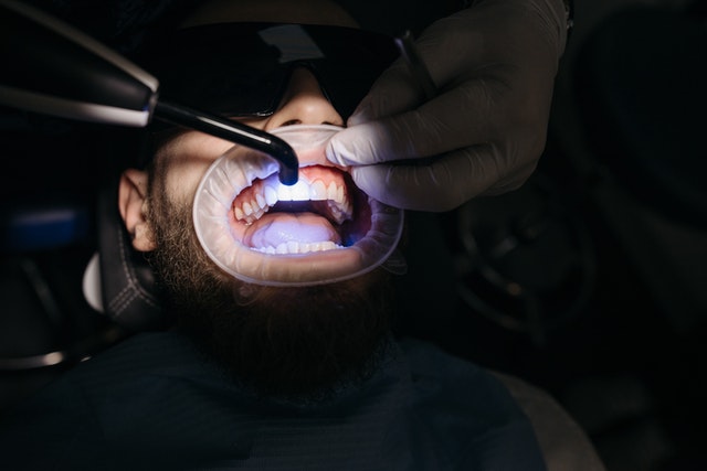 oral hygeine checkup with dentist